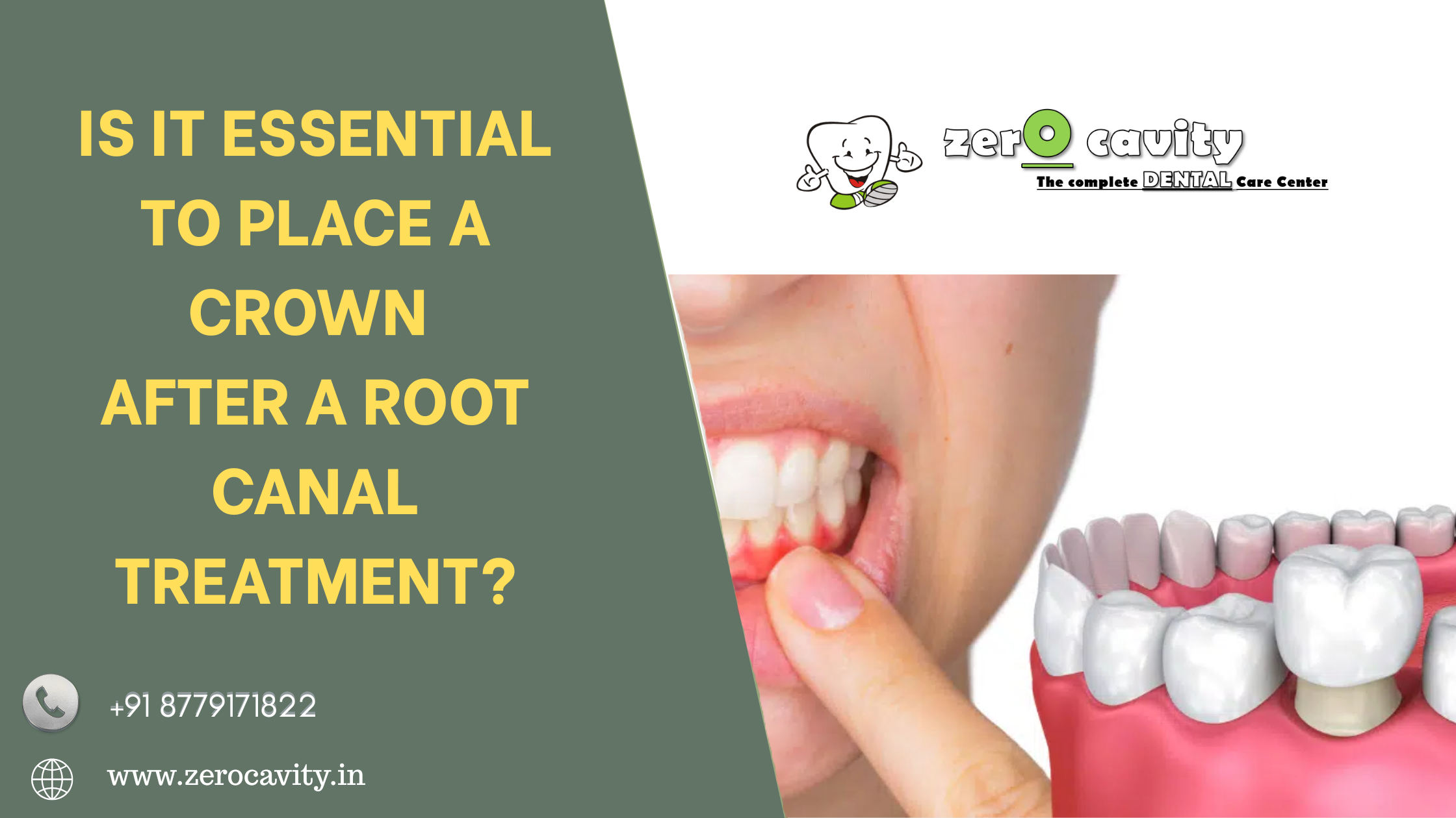 Why Do Dentists Suggest X-Rays for Small Problems? Are They Safe?